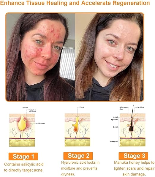 Bee Skin Elixir